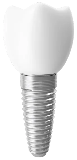 Dental implant