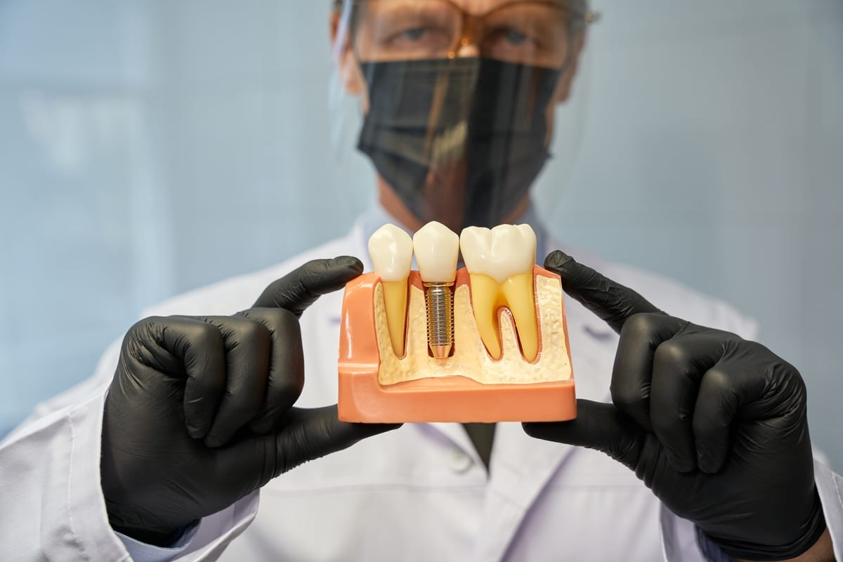 Implant Secured Dentures in Auburn