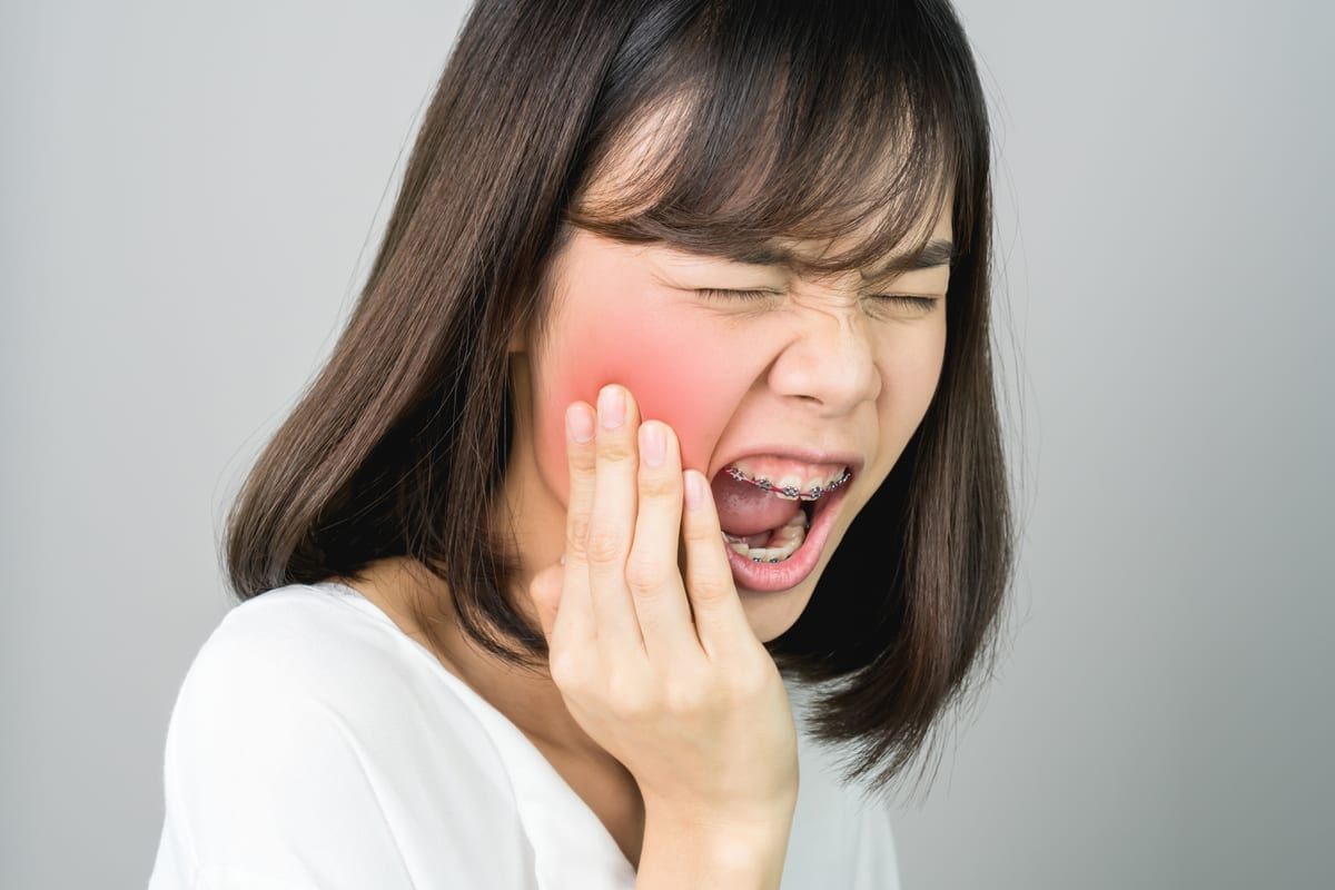 Tooth Extractions in Auburn