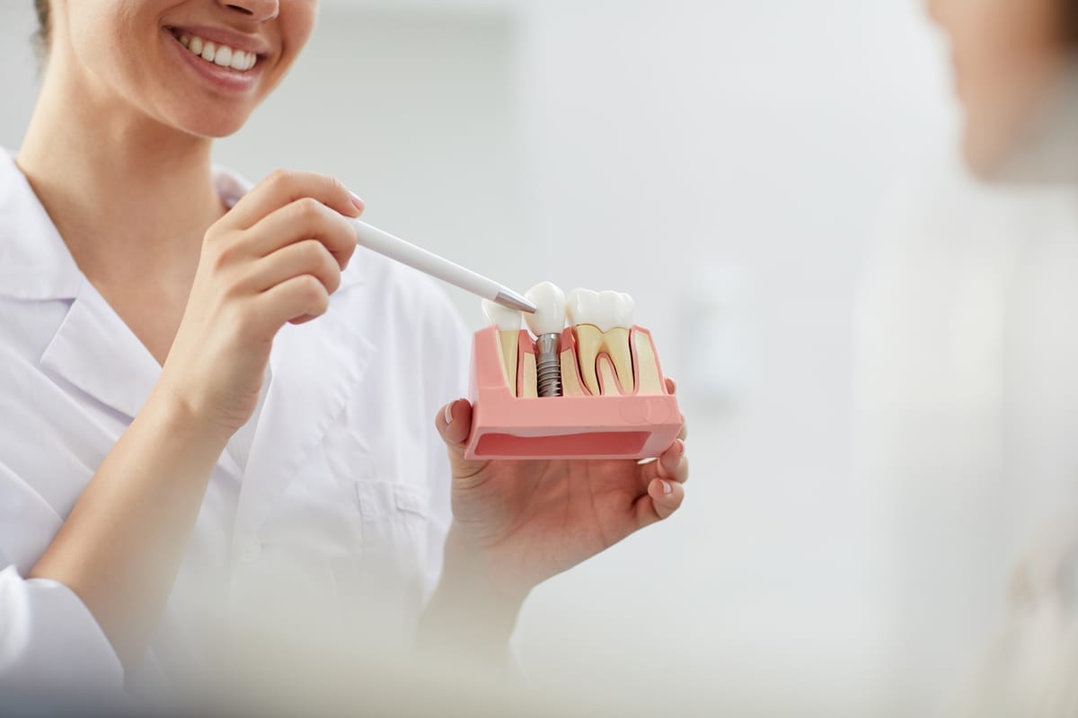 Implant Secured Dentures in Auburn